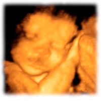 Фото 27 недели беременности