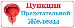 Пункция Щитовидной железы