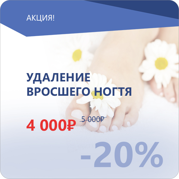 Скидка 20% на удаление вросшего ногтя