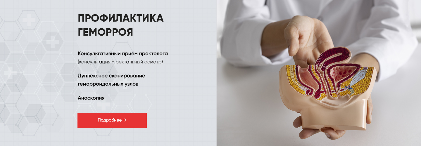 Профилактика геморроя &mdash; комфорт и здоровье каждый день