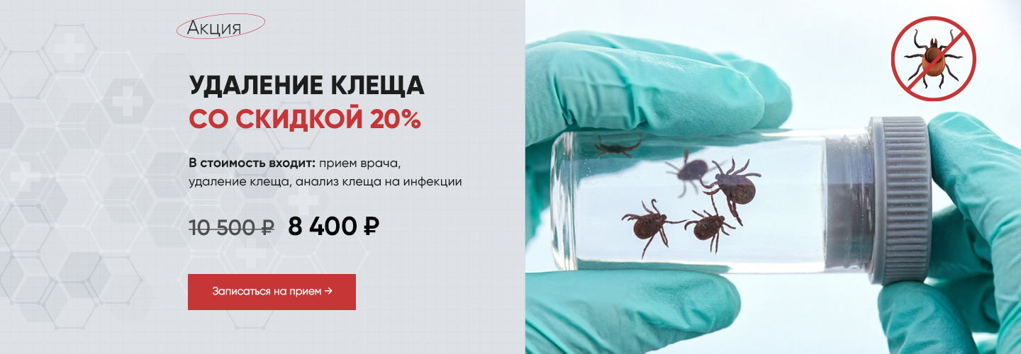 Удаление клеща со скидкой