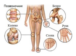 Лечение ортопедических патологий