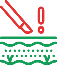 Удаление новообразований